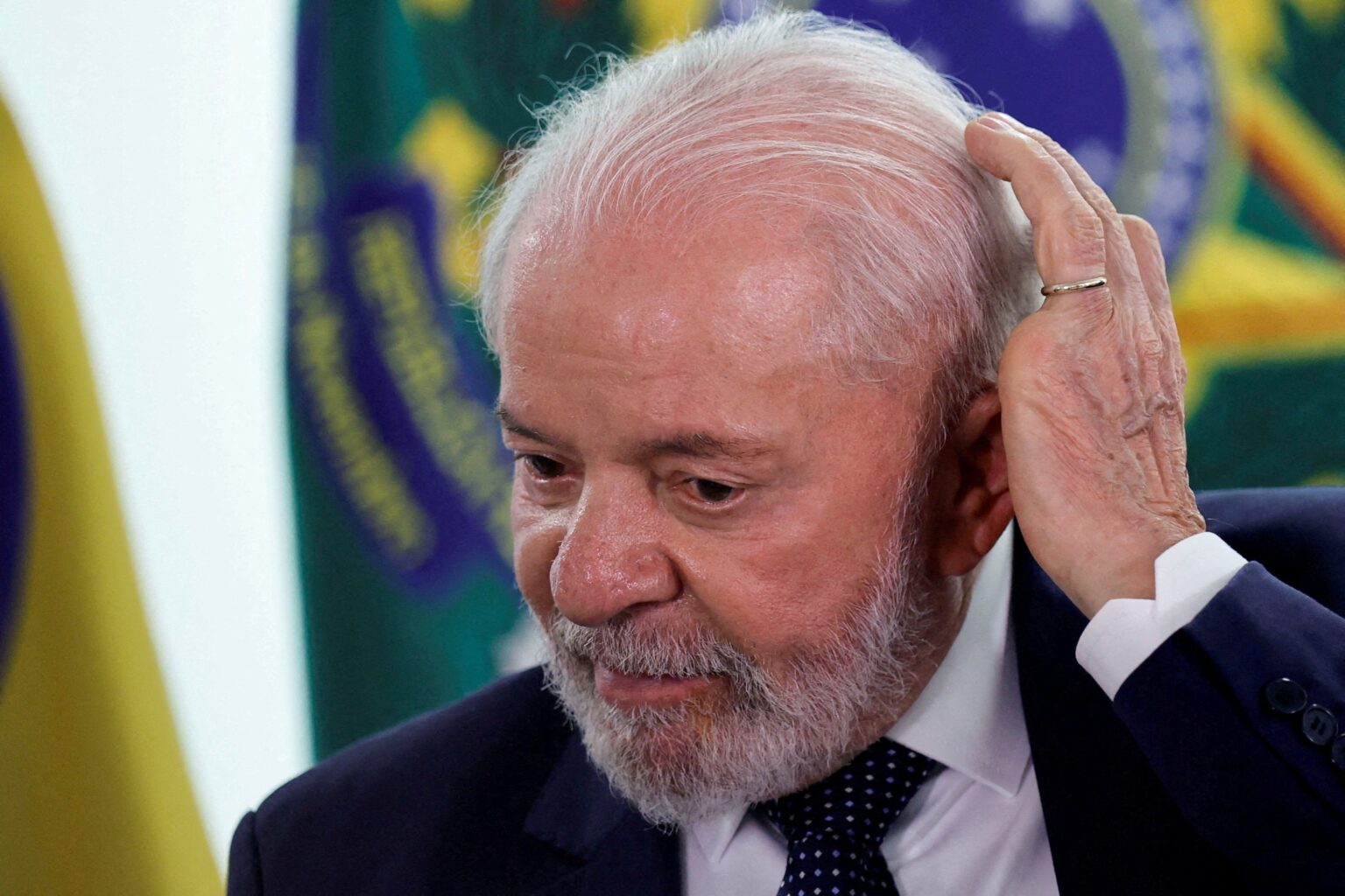 Lula Aparece com Curativos Pelo Seu Corpo e Médicos Confirmam O Que Aconteceu: “Perdeu Sua…Ver mais
